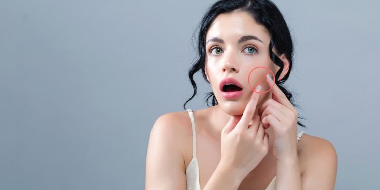 10 Things to NEVER Do to A Pimple