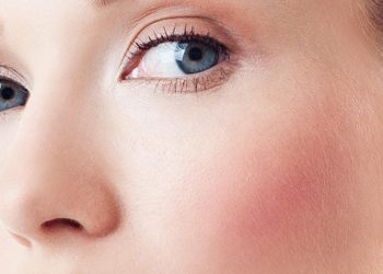 Blotchy Skin – and What to Do About It