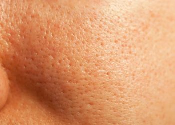 5 Treatments for Uneven Skin Texture That We Swear By