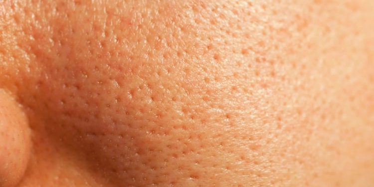 5 Treatments for Uneven Skin Texture That We Swear By