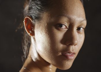 Does Sweat Cause Acne?