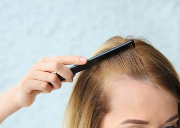 Rosemary vs. Minoxidil: Natural Hair Loss Solutions