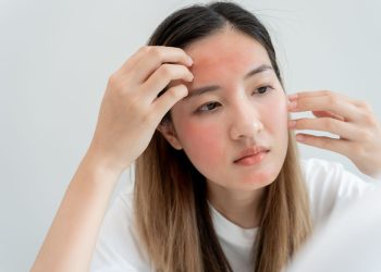 Understanding and Treating Rosacea Flare-Ups in Colder  Months