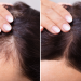 Natural Solutions for Hair Loss: Your Complete Guide to Regrowth